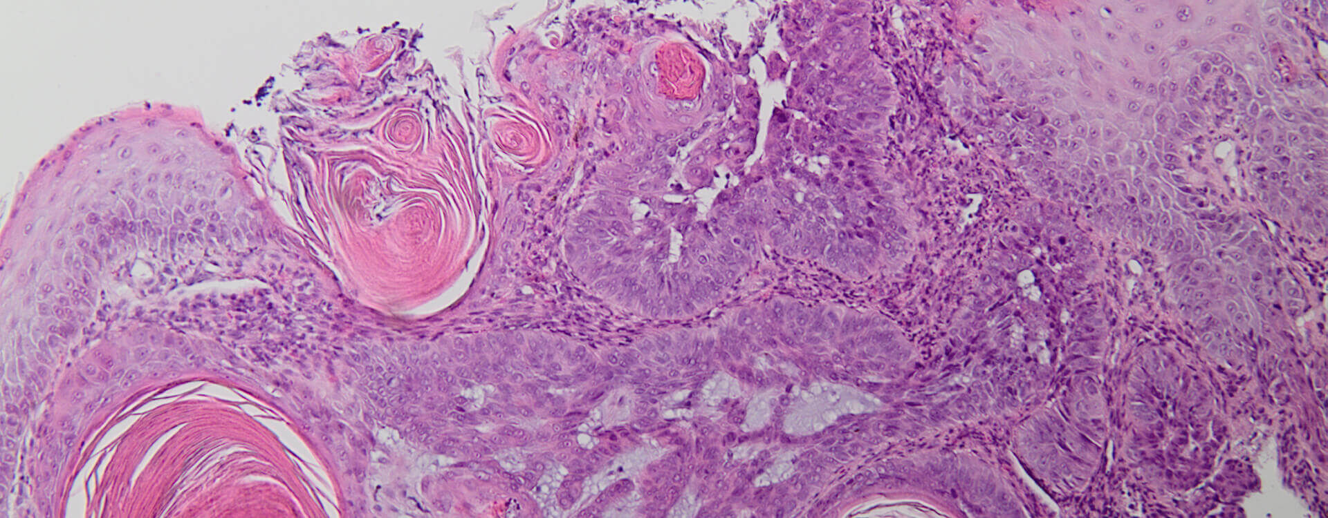 Pathologie-SH